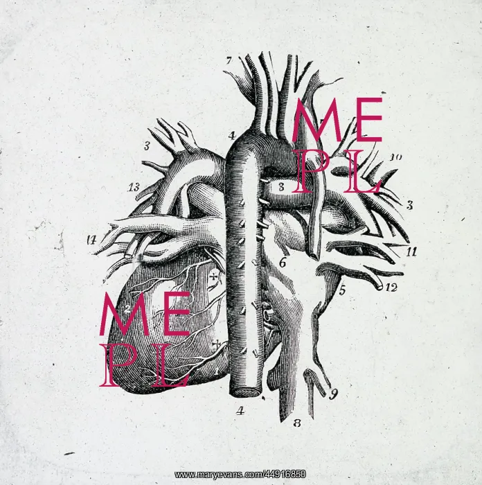 : X-Ray - Heart and Vessels : X-Ray - Heart and Vessels