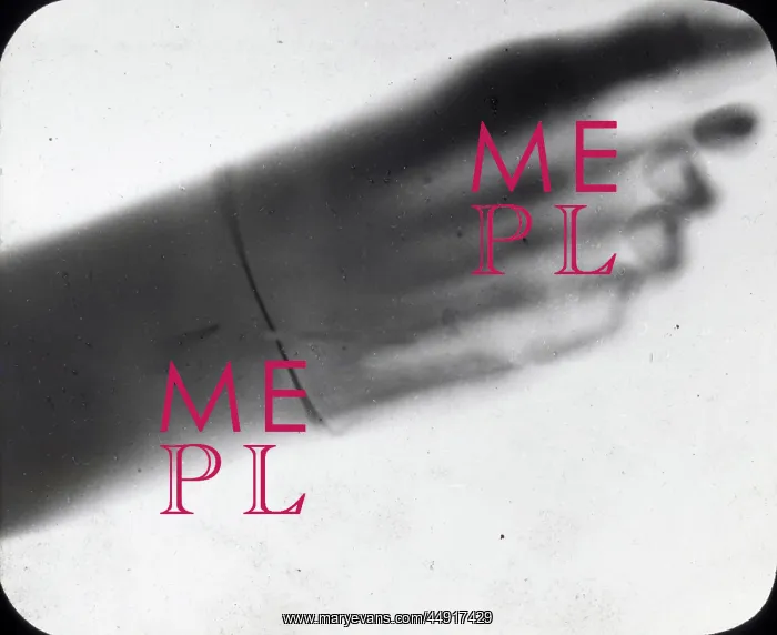 : X-Ray - Human Foot : X-Ray - Human Foot