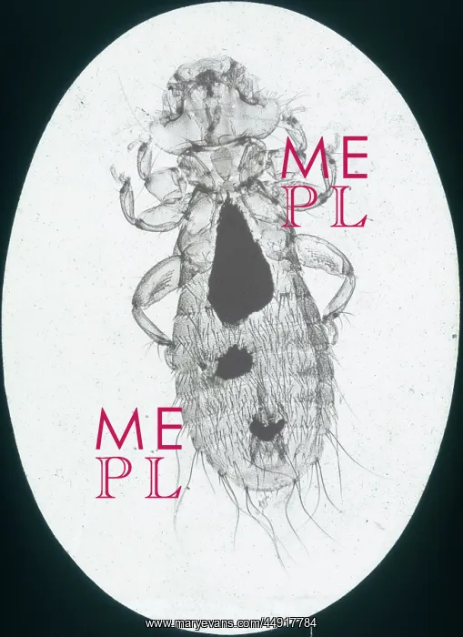 : X-Ray - Microscopic x-ray view of a small head louse : X-Ray - Microscopic x-ray view of a small head louse