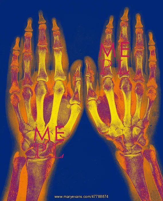 : X-Ray of Two Normal Hands, 1896 : X-Ray of Two Normal Hands, 1896