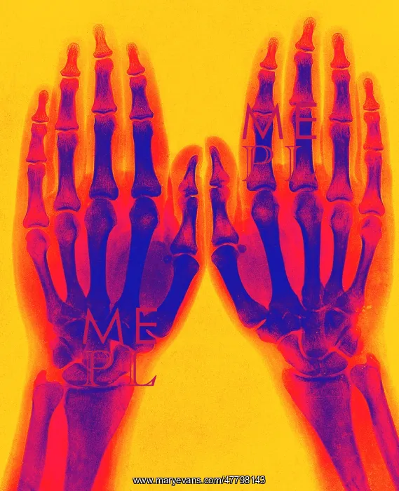 : X-Ray of Two Normal Hands, 1896 : X-Ray of Two Normal Hands, 1896