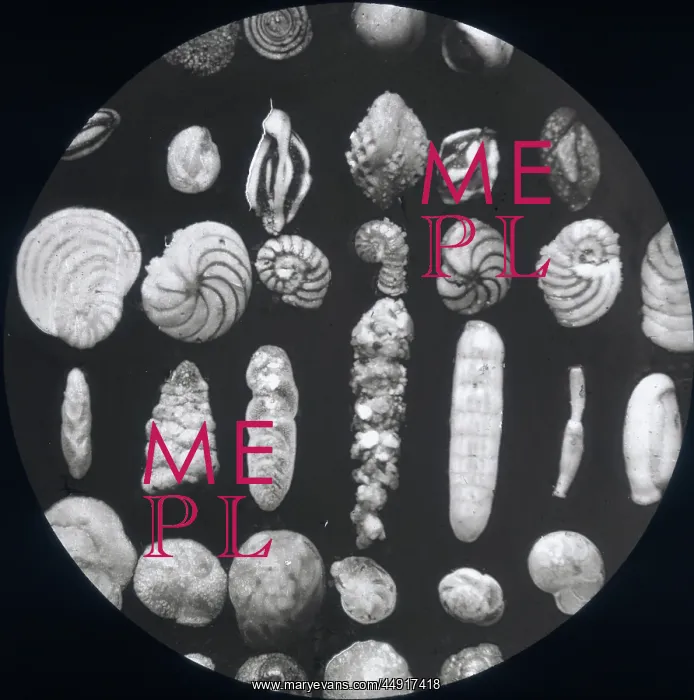 : X-Ray - Parasite Specimens : X-Ray - Parasite Specimens