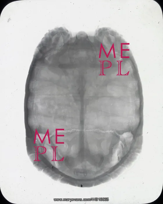 : X-Ray - Showing Skeleton of Tortoise : X-Ray - Showing Skeleton of Tortoise