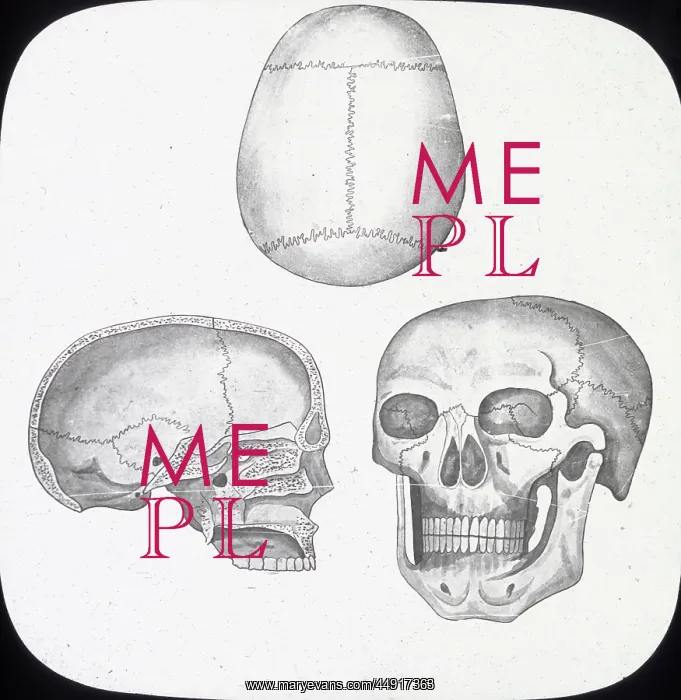 : X-Ray - Skull, Front, Top-and Section : X-Ray - Skull, Front, Top-and Section