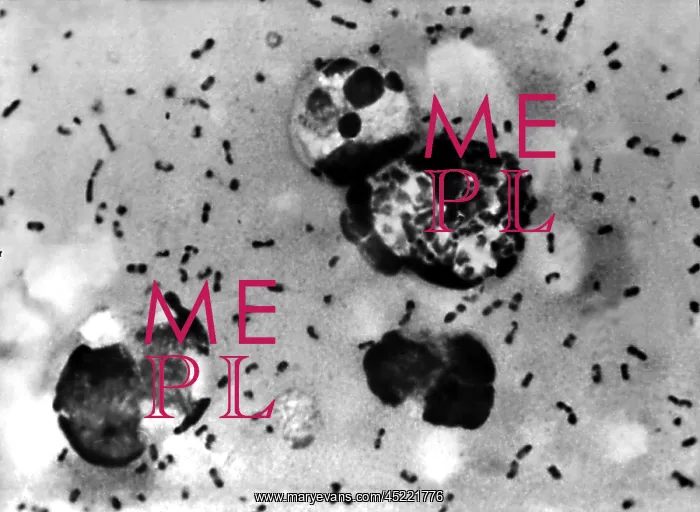 : Yersinia pestis bacteria which caused Bubonic ? : Yersinia pestis bacteria which caused Bubonic ?