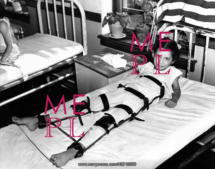 : Young Polio victim in bed with a body and ? : Young Polio victim in bed with a body and ?