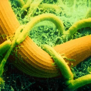 Arthrobotrys, SEM Arthrobotrys, SEM
