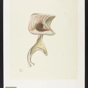 Enlargement of Biliary Ducts Enlargement of Biliary Ducts