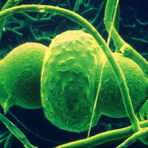 Rhizopus sexualis, SEM Rhizopus sexualis, SEM
