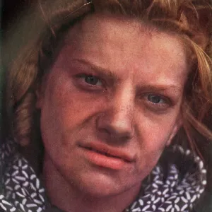 A victim of an Air Attack A victim of an Air Attack