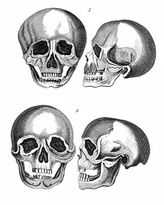Fringe: 1: Germanic skull with all the marks of a European