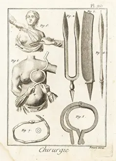 Mastectomy: 18th century mastectomy equipment