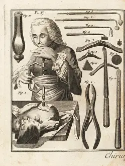 Trepanation: 18th century surgeon performing a trepanning