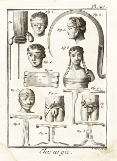 Truss: 18th century surgical equipment