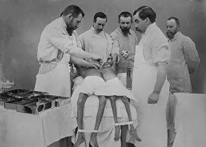 Deformity: 1912 operation separating young Indian conjoined ?