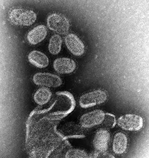 Pandemics: 1918 influenza virions (virus particles).?