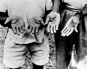 Woke: 1959 - Modern Miracle? - His Hands Have Been Altered