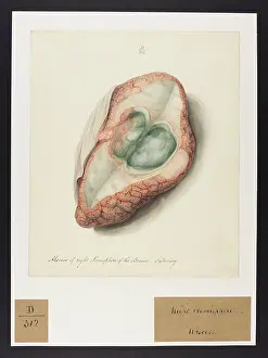 Hemisphere: Abscess of the Brain