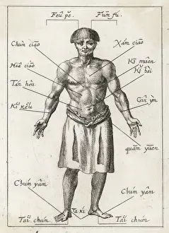 1686: ACUPUNCTURE IN 17TH CENT