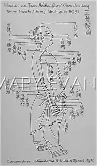 Acupuncture: Acupuncture -- the Calefacients