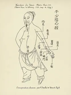 Acupuncture: Acupuncture -- the Heart