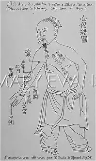 Acupuncture: Acupuncture -- the Heart