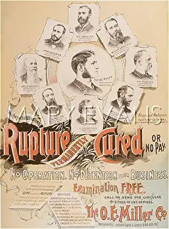 Disclosed: ADVERT/RUPTURE CURE 1892