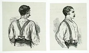 Braces: Adjustable braces with cross - tree fitment, designed