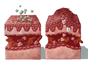 Comparing: Allergy Reaction on Skin, Illustration