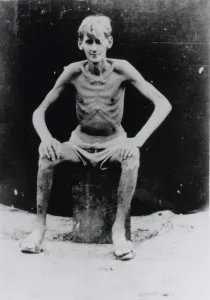 Pows: Allied prisoner of war in a poor physical condition