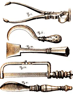 1772: Amputation Instruments, 1772