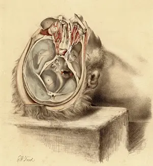 Dissection: ANATOMY/BASE OF SKULL