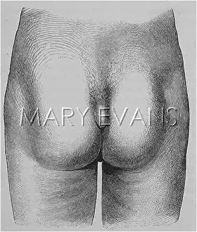 Rudimentary: ANATOMY/HUMAN TAIL