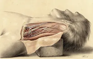 Mortem: Anatomy - Side of Neck