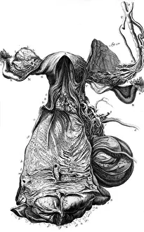 Haller: ANATOMY / UTERUS 18TH C