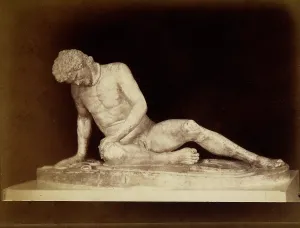 Pergamo: Ancient Sculpture Of Galata Morente