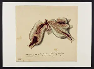 1831: Aneurysm of One of the Mesenteric Arteries (Horse)