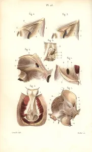 Abdomen: Aponeuroses of the abdomen and perineum