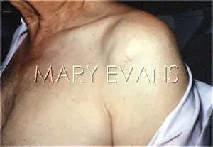 Healed: ARRIGO, PATIENT'S SCAR