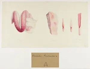 Ucl Library Services Digital Collections: Arteritis: Peritonitis