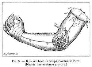 Surgical: Artificial arm by Ambroise Pare