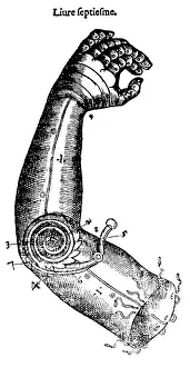 Attachment: Artificial Arm Designed by Ambroise Par?, 1564