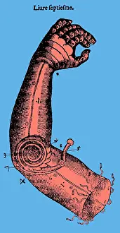 Elbow: Artificial Arm Designed by Ambroise Pare, 1564