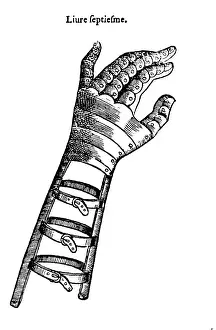 Attachment: Artificial Hand Designed by Ambroise Par?, 1564