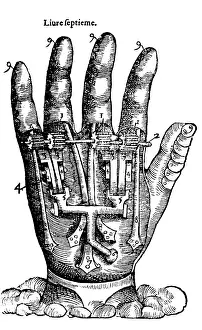 Forensic: Artificial Hand Designed by Ambroise Par?, 1564