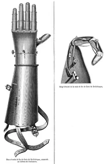 Surgery: Artificial hand of Goetz von Berlichingen