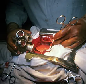Clinical: Artificial heart, 1974