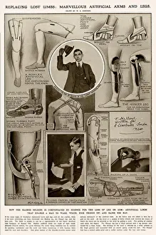 Rowley: Artificial limbs