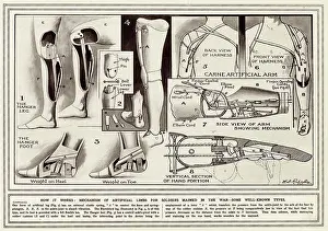 Elastic: Artificial limbs for soldiers maimed in WWI