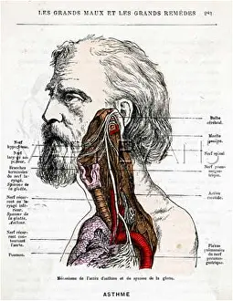 Asthma: ASTHMA SUFFERER
